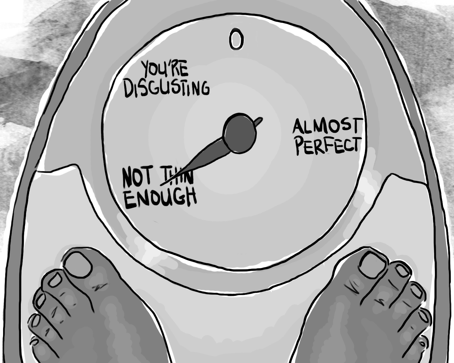 Eating Disorders (Anorexia Nervosa) – An Overview